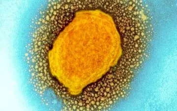 شناسایی "آبله‌میمون" در سوئیس و رژیم صهیونیستی