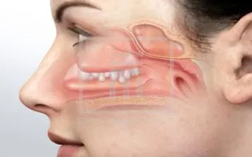 سریع ترین راه برای رفع گرفتگی بینی!