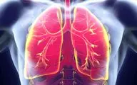 ریه‌ها به طرز جادویی آسیب ناشی از استعمال سیگار را برطرف می‌کنند