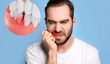 چرا مردان بیشتر از زنان به بیماری‌های دهان و دندان مبتلا می‌شوند؟