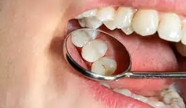 با این روش از پوسیدگی دندان جلوگیری کنید 