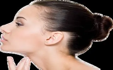 داروی مخصوص از بین بردن غبغب