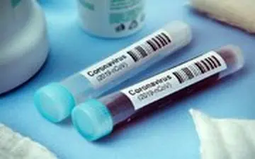 عفونت بی علامت کووید ۱۹ نشانه عملکرد ضعیف تر سیستم ایمنی است