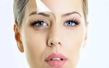  سیاهی دور چشم| از بین بردن سیاهی دور چشم با رژیم غذایی مناسب 