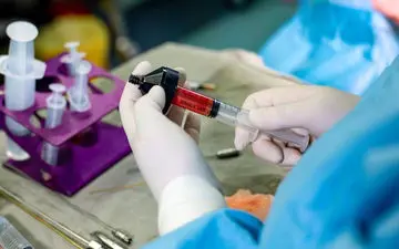 عمل تزریق چربی به واژن| مراقبت‌های پس از عمل تزریق چربی به واژن