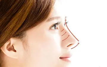 لیفت بینی با نخ چگونه است و چطور عمل می‌کند؟