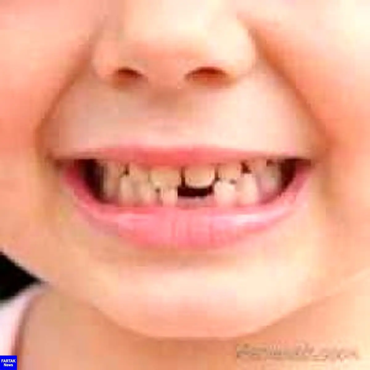 دانستنی های  جالب دندان شیری 