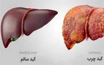 کبد چرب را با این چند میوه درمان کنید