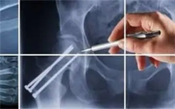  چگونه مفصل های سالم داشته باشیم؟