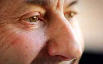 چند تغییر در چشم که علامت پارکینسون است