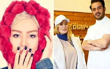 جراحی زیبایی سحر قریشی ! / سحر قریشی دنبال چیست ؟ / خودنمایی یا کمبود !!