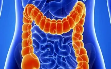 سرطان روده بزرگ | علائم سرطان مرگبار روده بزرگ را بشناسید