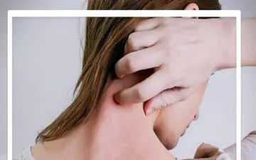 آیا به آفتاب حساسیت دارید؟ | این مطلب را بخوانید