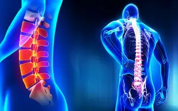 10 راه طبیعی برای کاهش درد مفاصل؛ به سلامتی مفاصل خود برسید