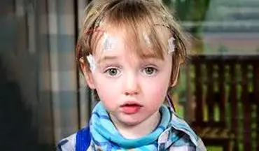 در مورد صرع کودکان بیشتر آگاه باشید!