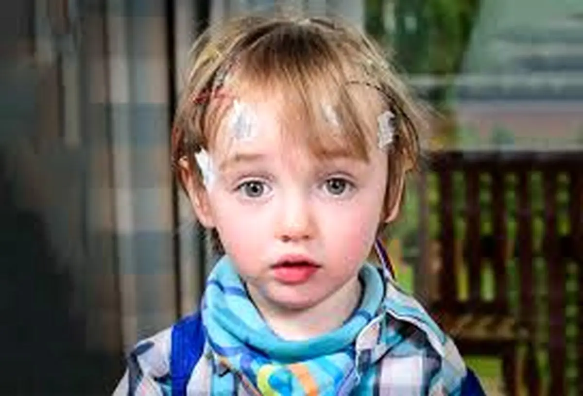 در مورد صرع کودکان بیشتر آگاه باشید!