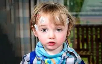 در مورد صرع کودکان بیشتر آگاه باشید!