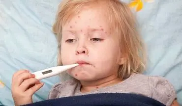 وضعیت سرخک و سرخجه در کشور چگونه است؟ / موثرترین راه کنترل بیماری‌های واگیردار