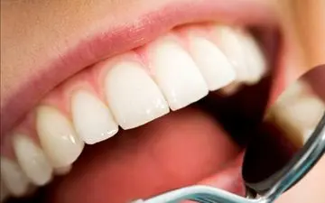 با کمبود این ویتامین‌ها دندان ها دچار پوسیدگی می شوند

