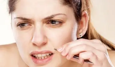چگونه با روش‌های خانگی از موهای زائد پشت لب خلاص شویم؟| معرفی ۱۶ روش طبیعی و مؤثر