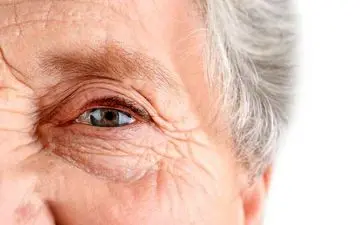 نشانه های پیرچشمی چیست؟

