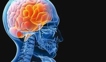 بلوغ زودرس خطر ابتلا به سکته مغزی را افزایش می‌دهد/ استرس زنگ خطری برای بروز سکته مغزی
