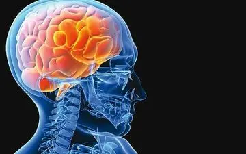 بلوغ زودرس خطر ابتلا به سکته مغزی را افزایش می‌دهد/ استرس زنگ خطری برای بروز سکته مغزی