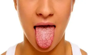  با قهوه به جنگ بوی دهان بروید | درمان بوی بد دهان با قهوه