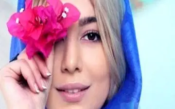 خانم بازیگر مشهور با موهای قرمز رنگ عجیب بر بالین الناز شاکردوست 