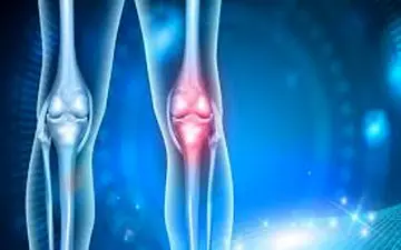 همه باید در مورد التهاب مفاصل بدانند!