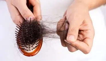 رازهای تشخیص ریزش موی طبیعی از غیرطبیعی