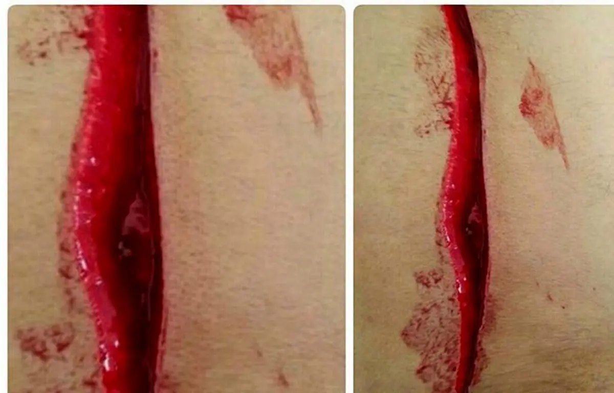 حمله خونین دانش آموز هنرستانی به مدیر مدرسه در جیرفت