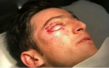 مصدومیت شدید سردار در تمرین امروز روبین کازان