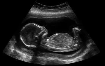 9 روش خانگی تعیین جنسیت جنین بدون سونوگرافی