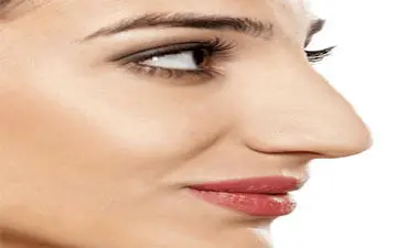 درمان پل بینی به دو روش ایمپلنت و استئوتومی