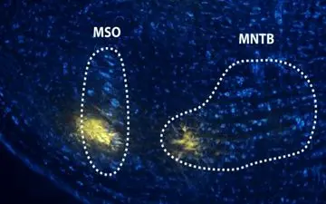 بررسی عملکرد مغز در تشخیص صحبت و صدا 
