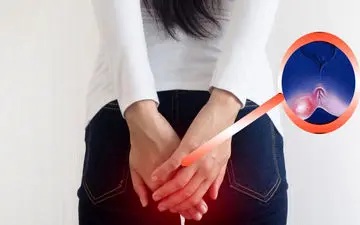 جوش‌های نشیمنگاه| درمان جوش‌های نشیمنگاه با ۹ روش