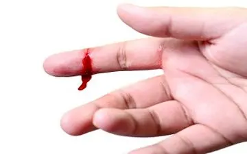 نشستن پای در دل بیماران یک بیماری خاص + فیلم