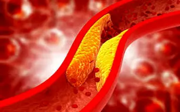 برای کاهش  کلسترول بد این کارها را بکنید!