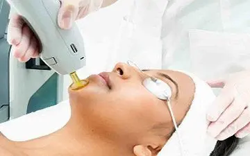  آیا لیزر موهای زائد می تواند باعث سرطان شود؟