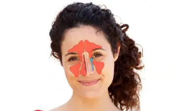 تنگی مجرای بینی چه عوارضی دارد