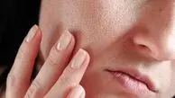 ۱۰ راز برای داشتن پوست سالم