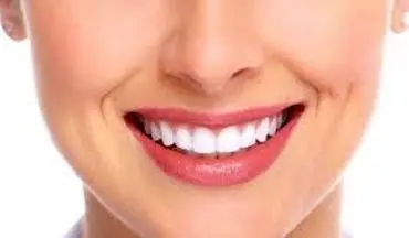 چگونه دندان های سفیدتری داشته باشیم؟