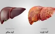 پایان کبد چرب/ قدرت شگفت‌انگیز انتخاب‌های روزمره شما!