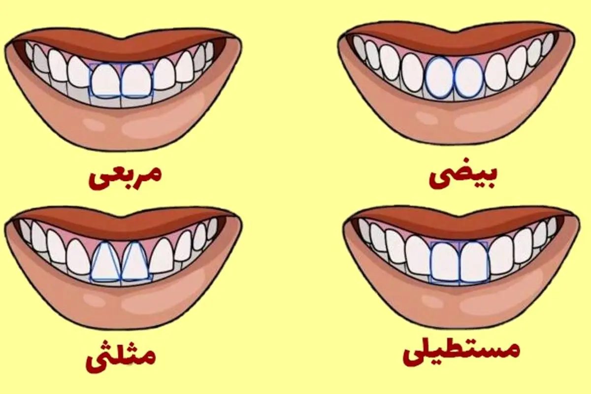 شخصیت شناسی از روی شکل دندان