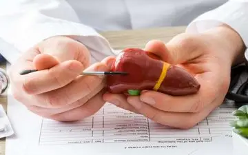 راه‌های طبیعی و خانگی برای درمان کبد چرب