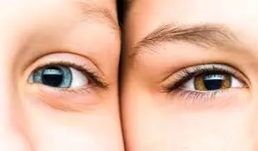 راه و روش تغییر رنگ چشم بدون جراحی و لیزر در ۶۰ روز