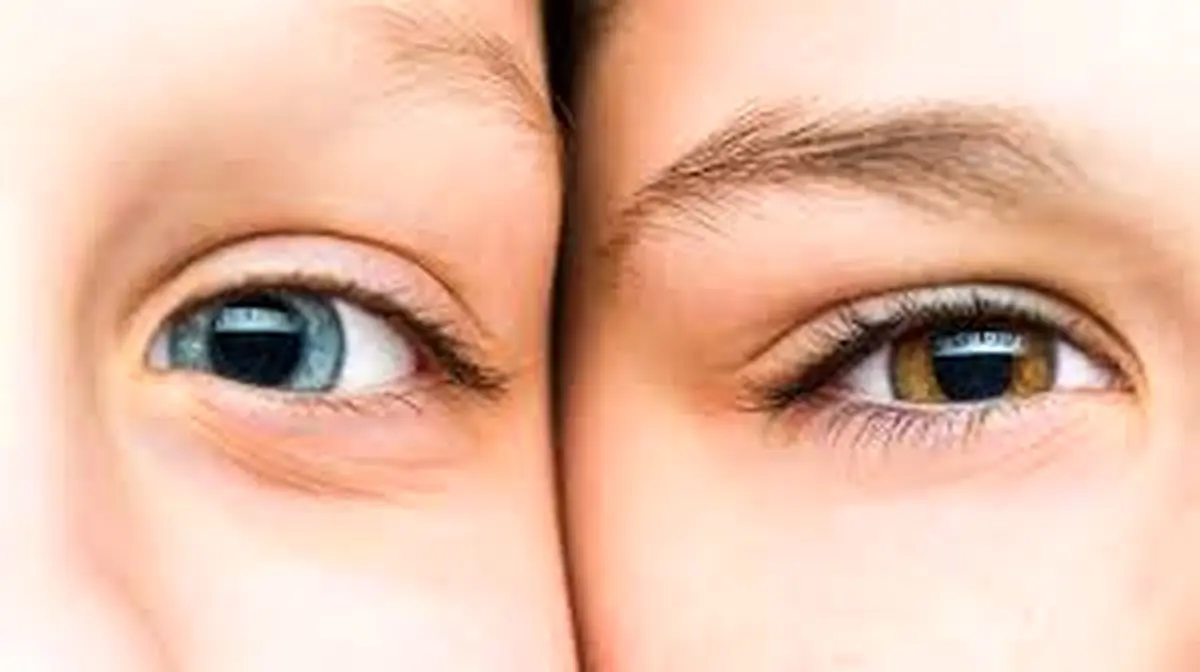 راه و روش تغییر رنگ چشم بدون جراحی و لیزر در ۶۰ روز