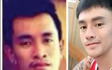 جراحی زیبایی میلیاردی برای شبیه شدن به کره ای ها + عکس