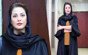 چهره باورنکردنی طناز طباطبایی بعد از عمل زیبایی !! / چهره طناز طباطبایی غیر قابل تشخصی شد!! + عکس